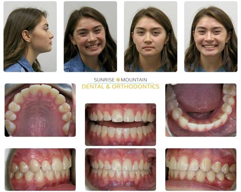 orthodontics in henderson